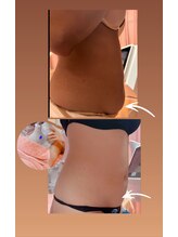 ザネイルベニュー/【県内希少最新】360℃脂肪冷却