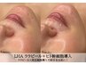 毛穴/赤みケア【はじける毛穴レス肌】LHAララピール＋ヒト幹細胞導入 ¥12,000