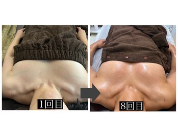 ハーズプラス(hers+)/50代。垂れとハリにお悩みの方