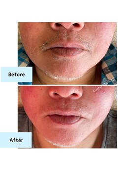 ルアナラウンジ(Luana Lounge)/