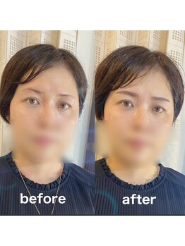 美ラボ リッチエンジェル/韓国アーチ眉