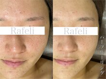 ラフェリ(Rafeli)