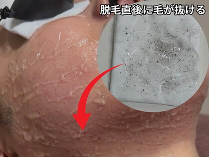 アテ 古波蔵店(ATE)の写真