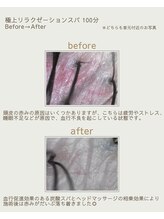 カピリナ(KaPilina)/頭皮のBefore→After