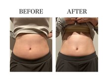 ルアバイアロ(Lua by Alo's)/