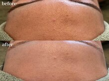 リボーン 浜松(reborn)/