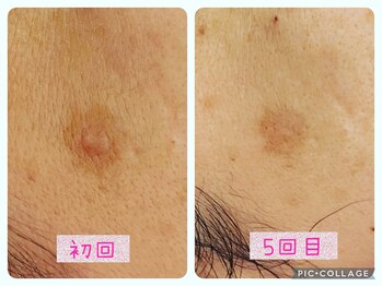 ビューティーサロン キャンディ 海老名(Candy)/