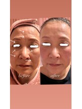 ザネイルベニュー/フェイシャルセットお得！