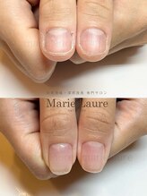 マリーロール 淀屋橋本店(Marie Laure)/自爪育成/深爪矯正/ネイルケア