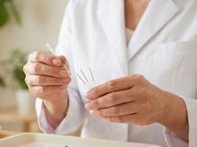 美容鍼は眠ってしまう方も多く、リラックスできます