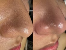 サラグランデ(Sara Grande)/近距離で見られても自信あり♪