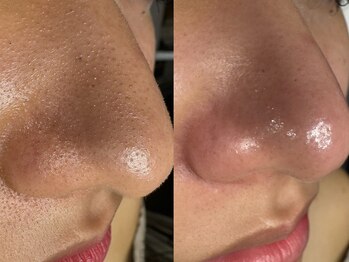 サラグランデ(Sara Grande)/近距離で見られても自信あり♪