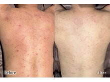 アネル 新都心店(anel)/