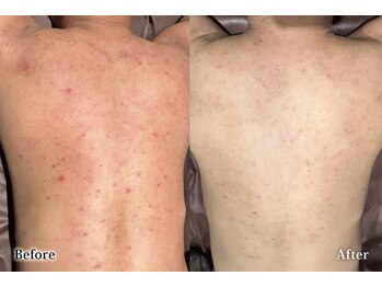 アネル 新都心店(anel)/