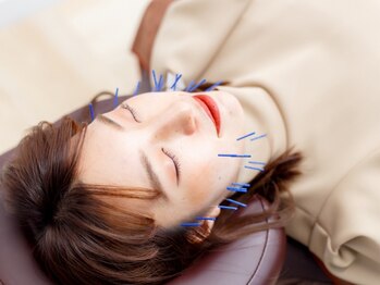 デサフィオ(Desafio)の写真/【あご肉ごっそり★】電気鍼を使用した最強リフトUP！リンパを流して小顔に◎たるみ/シワ/ほうれい線にも♪