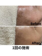 リンパケアルーム ヘンプ(hemp)/今話題のホワイトラボ♪