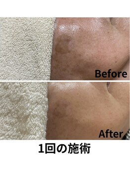 リンパケアルーム ヘンプ(hemp)/今話題のホワイトラボ♪