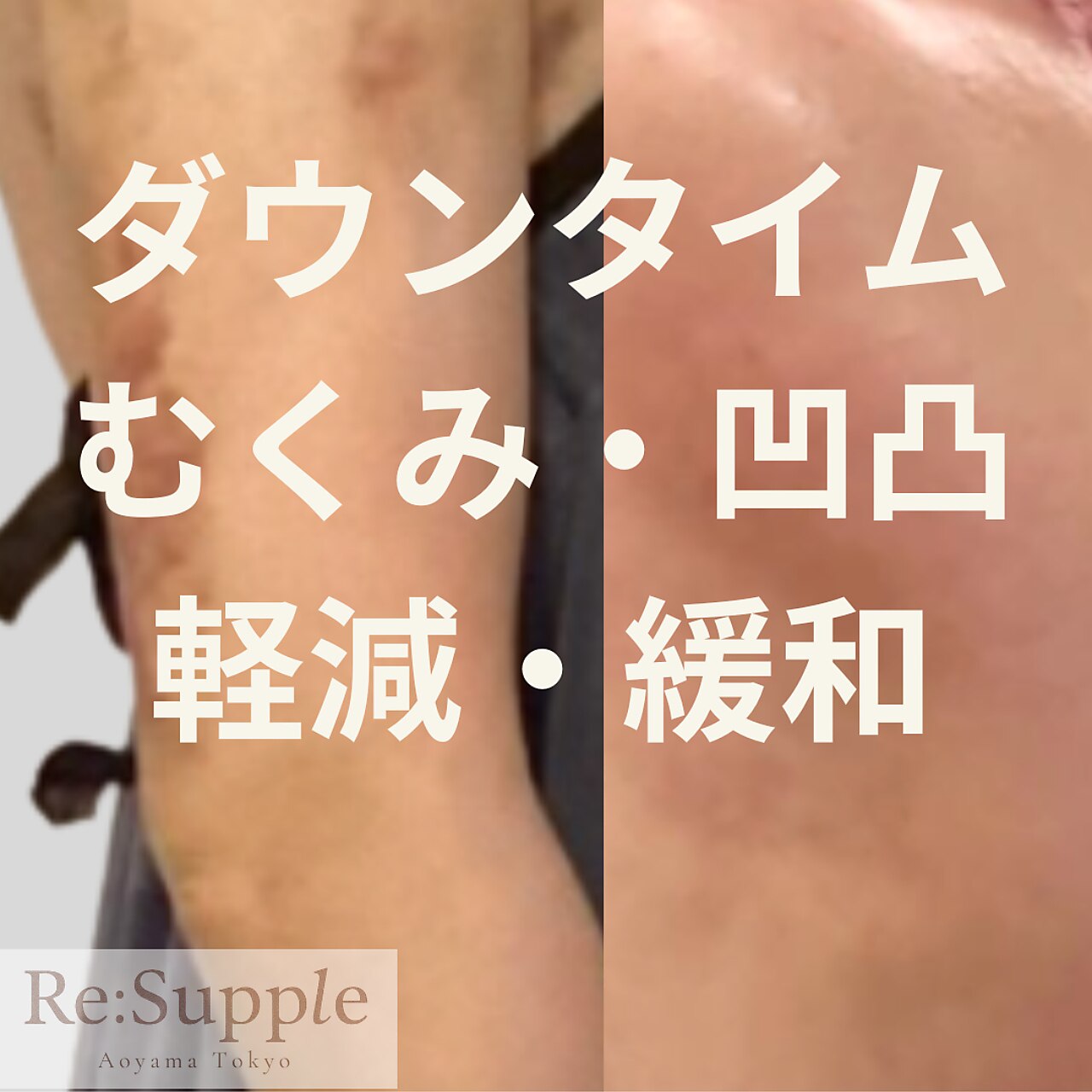 リサプリ(Re: Supple)｜ホットペッパービューティー