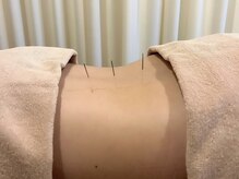 茶ノ木鍼灸整骨院/