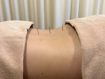 茶ノ木鍼灸整骨院/