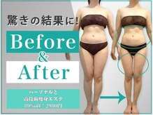 ジーンモチベーション 大阪店(GENE MOTIVATION)