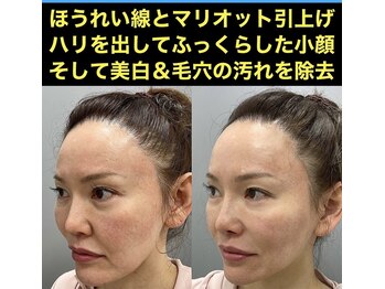 スペチアーレ 夙川/小顔と美肌で美顔革命