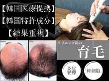 【韓国医療提携】育毛促進×美肌管理専門サロン CURAIM 熊本