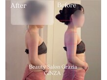 グラツィア 銀座(Grazia)/体験1回 [ブライダルエステ整体]