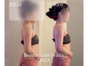 グラツィア 銀座(Grazia)/体験1回 [ブライダルエステ整体]