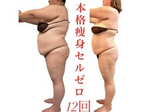 リノア(Lino'aka)/人生最後の痩身　○○さんの変化