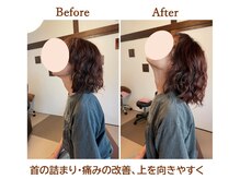 整体 ドライヘッドスパ よみがえる/ビフォーアフター