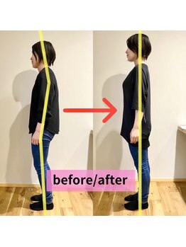 整体院リハイロ 新涯店/ビフォーアフター2