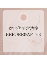 エクシア(Excia)/次世代毛穴洗浄