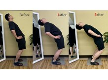 アプロ(APLO)/自律神経調整＋姿勢矯正