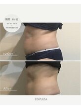 エスプライザ 横浜駅前店/お洋服のサイズがダウン↓