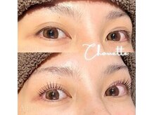 シュエット(Chouette)の雰囲気(【認定講師の施術】一人一人スペシャリストで安心施術ができる)