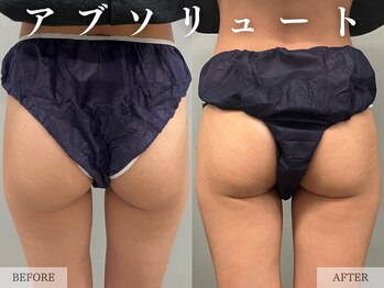 レヴェリー 心斎橋店(REVERIE)/- ヒップアップ -