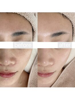 フェリノ(FERINO)/くすみ、ニキビや赤みにも◎