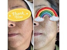 パールブルー(All Perl blue)の雰囲気（夏のダメージ肌お手入れキュラハ月2回のキュラハで韓国美肌）