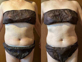 マロカ(Marroka)/50代。週1回パーソナル継続中