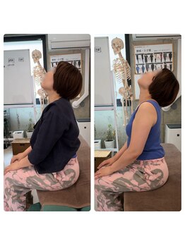 香椎井上整骨 整体院/肩こり頭痛を根本から改善