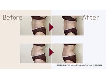 ワイオリ(WAIOLI)