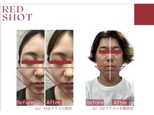 スプレール 水戸店/RED SHOT レッドショット