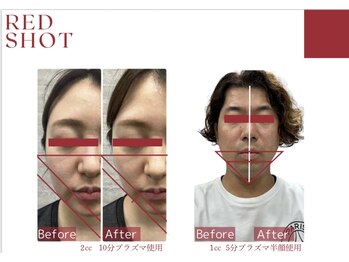 スプレール 水戸店/RED SHOT レッドショット
