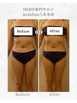 エーシーサロン 六本木店(acsalon)/繰り返すリバウンドに終止符!