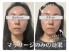《平日10時～14時予約限定！〉結果重視の小顔体験◎60分