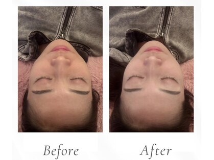 小顔矯正×美容整体×ヘッドケア　MiuR -ミュール-の写真