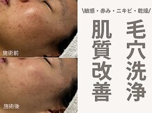 サンラックスサロン 岐阜(SANlux Salon)