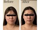エヌズクレール(N's Claire)の写真