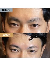 眉毛ハウス 吉祥寺店(眉毛HOUSE)/お客様の施術例(吉祥寺/東京)